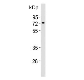 Western blot testing of mouse pancreas tissue lysate with Nr4a2 antibody. Predicted molecular weight ~67 kDa.