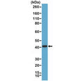 Western blot testing of human LNCaP cell lysate with recombinant AMACR antibody at 1:1000 dilution. Predicted molecular weight ~43 kDa.