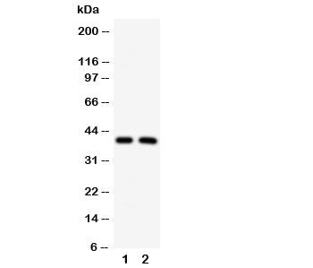 Western blot testing of IRF2 antibody and Lane 1: HeLa; 2: MCF-7 cell lysate. Estimated molecular weight: ~39kDa but routinely observed at 39-50kDa.