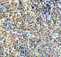 Immunohistochemical staining of SPATA6 using anti-SPATA6 antibody. SPATA6 was detected in a paraffin-embedded section of human testis cancer tissue. Heat mediated antigen retrieval was performed in EDTA buffer (pH 8.0, epitope retrieval solution). The tissue section was blocked with 10% goat serum. The tissue section was then incubated with 2 ug/ml rabbit anti-SPATA6 antibody overnight at 4oC. Peroxidase Conjugated Goat Anti-rabbit IgG was used as secondary antibody and incubated for 30 min at 37oC.