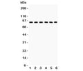 Western blot testing of Oct-1 antibody and Lane 1: rat liver; and human samples 2: placenta; 3: Jurkat; 4: HeLa; 5: A549; 6: SMMC-7721. Predicted molecular weight ~89 kDa.
