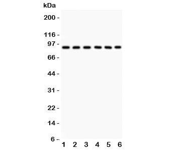 Western blot testing of Oct-1 antibody and Lane 1: rat liver; and human samples 2: placenta; 3: Jurkat; 4: HeLa; 5: A549; 6: SMMC-7721. Predicted molecular weight ~89 kDa.