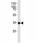 Western blot analysis of lysate from HUVEC cell line using Gapdh antibody. Ab was diluted at 1:1000. Predicted molecular weight ~36kDa.