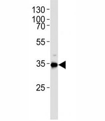Western blot analysis of lysate from HUVEC cell line using Gapdh antibody. Ab was diluted at 1:1000. Predicted molecular weight ~36kDa.