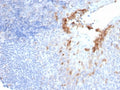 IHC staining of FFPE human prostate tissue with recombinant CD10 antibody (clone MME/6696R). HIER: boil tissue sections in pH 9 10mM Tris with 1mM EDTA for 20 min and allow to cool before testing.