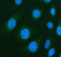 Immunofluorescent staining of PIK3C2A using anti-PIK3C2A antibody (green). PIK3C2A was detected in an immunocytochemical section of Hela cells. Enzyme antigen retrieval was performed using IHC enzyme antigen retrieval reagent for 15 mins. The cells were blocked with 10% goat serum. And then incubated with 5 ug/ml rabbit anti-PIK3C2A antibody overnight at 4oC. DyLight 488 Conjugated Goat Anti-Rabbit IgG was used as secondary antibody at 1:500 dilution and incubated for 30 min at 37oC.