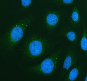 Immunofluorescent staining of PIK3C2A using anti-PIK3C2A antibody (green). PIK3C2A was detected in an immunocytochemical section of Hela cells. Enzyme antigen retrieval was performed using IHC enzyme antigen retrieval reagent for 15 mins. The cells were blocked with 10% goat serum. And then incubated with 5 ug/ml rabbit anti-PIK3C2A antibody overnight at 4oC. DyLight 488 Conjugated Goat Anti-Rabbit IgG was used as secondary antibody at 1:500 dilution and incubated for 30 min at 37oC.