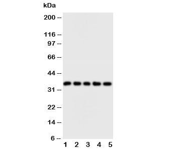 Western blot testing of FosB antibody and Lane 1: HT1080; 2: SW620; 3: HeLa; 4: SMMC-7721; 5: MM453 cell lysate. Expected/observed molecular weight ~36 kDa.