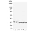 Western blot testing of RAB9 antibody and Lane 1: rat brain; 2: mouse brain; 3: human HeLa; 4: (r) PC12; 5: (m) NIH3T3; 6: (h) A431; 7: (h) 293T lysate. Expected/observed molecular weight: ~23 kDa.