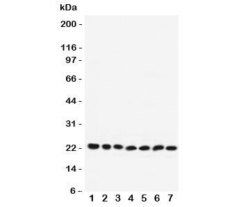 Western blot testing of RAB9 antibody and Lane 1: rat brain; 2: mouse brain; 3: human HeLa; 4: (r) PC12; 5: (m) NIH3T3; 6: (h) A431; 7: (h) 293T lysate. Expected/observed molecular weight: ~23 kDa.