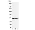 Western blot testing of TRAF1 antbody and recombinant human protein, 30.6KD with tag; Lane 1: 5ng; 2: 2.5ng; 3: 1.25ng