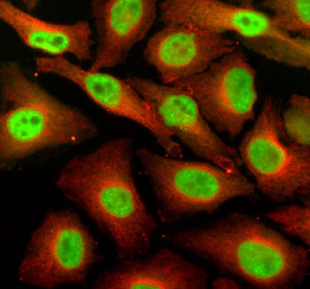 Immunofluorescent staining of SUPT16H using anti-SUPT16H antibody (green) and anti-Beta Tubulin antibody (red). SUPT16H was detected in an immunocytochemical section of Hela cells. Enzyme antigen retrieval was performed using IHC enzyme antigen retrieval reagent for 15 mins. The cells were blocked with 10% goat serum. And then incubated with 5 ug/ml rabbit anti-SUPT16H antibody and mouse anti-Beta Tubulin antibody overnight at 4oC.