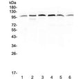 Western blot testing of human 1) placenta, 2) HepG2, 3) A549, 4) PANC-1, 5) SGC-7901 and 6) MDA-MB-231 lysate with MVP antibody at 0.5ug/ml. Observed molecular weight: 104~110 kDa.