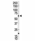 Western blot analysis of p70 S6 Kinase beta antibody and A375 cell lysate. Predicted molecular weight: 60-70 kDa