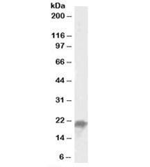 Western blot testing of mouse liver lysate with UBE2F antibody at 0.05ug/ml. Predicted molecular weight: ~21kDa.