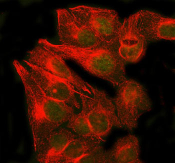 Immunofluorescent staining of RAD51B using anti-RAD51B antibody (green) and anti-Beta Tubulin antibody (red). RAD51B was detected in an immunocytochemical section of U2OS cells. Enzyme antigen retrieval was performed using IHC enzyme antigen retrieval reagent for 15 mins. The cells were blocked with 10% goat serum. And then incubated with 5 ug/ml rabbit anti-RAD51B antibody and mouse anti-Beta Tubulin antibody overnight at 4oC.