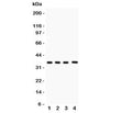 Western blot testing of PBK antibody and Lane 1: rat testis; 2: mouse testis; 3: human placenta; 4: (h) Jurkat lysate. Predicted molecular weight: ~36 kDa.