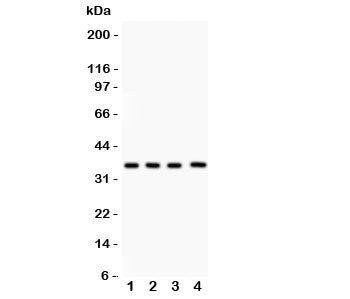 Western blot testing of PBK antibody and Lane 1: rat testis; 2: mouse testis; 3: human placenta; 4: (h) Jurkat lysate. Predicted molecular weight: ~36 kDa.