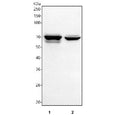 Western blot testing of human 1) HepG2 and 2) A549 cell lysate with TGF beta Receptor II antibody. Expected molecular weight ~65 kDa, routinely observed at 65-80 kDa.