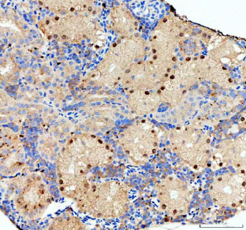 Immunohistochemical analysis of Nol10 protein using Zebrafish Nol10 antibody, HRP secondary and DAB substrate with paraffin-embedded zebrafish kidney tissue. HIER: boil tissue sections in pH8 EDTA for 20 min and allow to cool before testing.