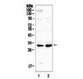 Western blot testing of 1) rat brain and 2) mouse spleen lysate with IL1B antibody at 0.5ug/ml. Predicted molecular weight ~31 kDa.