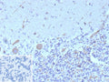 IHC staining of FFPE human brain tissue with FLT3 antibody (clone FLT3/9884). Inset: PBS used in place of primary Ab (secondary Ab negative control). HIER: boil tissue sections in pH 9 10mM Tris with 1mM EDTA for 20 min and allow to cool before testing.