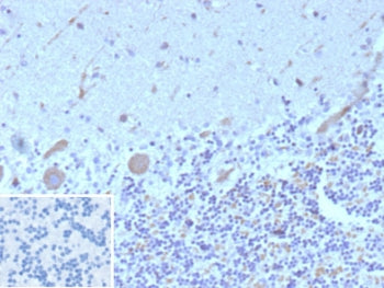 IHC staining of FFPE human brain tissue with FLT3 antibody (clone FLT3/9884). Inset: PBS used in place of primary Ab (secondary Ab negative control). HIER: boil tissue sections in pH 9 10mM Tris with 1mM EDTA for 20 min and allow to cool before testing.
