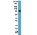 Western blot testing of human Raji cell lysate with CD19 antibody at 1:1000. Expected molecular weight: 60~100 kDa depending on glycosylation level.
