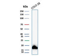 Western blot testing of human COLO-38 cell lysate with recombinant MART-1 antibody (clone MLANA/8108R). Expected molecular weight ~20 kDa with possible doublet.