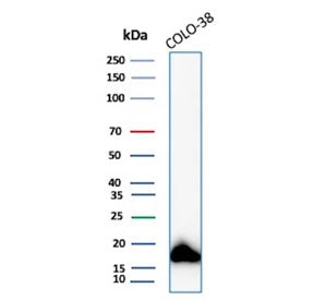 Western blot testing of human COLO-38 cell lysate with recombinant MART-1 antibody (clone MLANA/8108R). Expected molecular weight ~20 kDa with possible doublet.