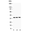 Western blot testing of GM-CSF antibody and Lane 1: Jurkat; 2: HeLa; 3: HT1080; The protein is visualized between 14~35KD depending on glycosylation.