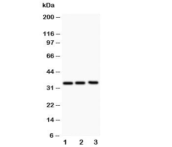 Western blot testing of GM-CSF antibody and Lane 1: Jurkat; 2: HeLa; 3: HT1080; The protein is visualized between 14~35KD depending on glycosylation.