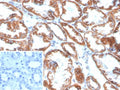IHC staining of FFPE human kidney tissue with Phospholipase A2 Receptor 1 antibody (clone PLA2R1/4898). Inset: PBS used in place of primary Ab (secondary Ab negative control). HIER: boil tissue sections in pH 9 10mM Tris with 1mM EDTA for 20 min and allow to cool before testing.