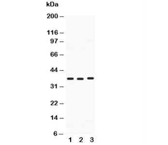 Western blot testing of Midkine antibody and Lane 1: HeLa; 2: SMMC-7721; 3: SW620; Predicted size: 16KD; Observed size: 38KD