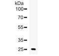 Western blot testing of human ESM1 recombinant protein (1ng/lane) with ESM1 antibody at 0.5ug/ml.