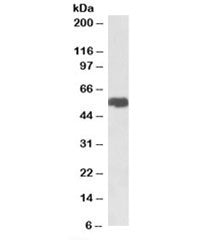Western blot testing of breast cancer lysate with SLC40A1 antibody at 1ug/ml. Predicted molecular weight: ~62 kDa.