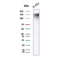 Western blot testing of A431 lysate using Epidermal Growth Factor Receptor antibody. Expected molecular weight: 134-180 kDa depending on glycosylation level.