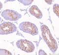 Immunohistochemical staining of STK31 using anti-STK31 antibody. STK31 was detected in a paraffin-embedded section of mouse testis tissue. Heat mediated antigen retrieval was performed in EDTA buffer (pH 8.0, epitope retrieval solution). The tissue section was blocked with 10% goat serum. The tissue section was then incubated with 2 ug/ml rabbit anti-STK31 antibody overnight at 4oC. Peroxidase Conjugated Goat Anti-rabbit IgG was used as secondary antibody and incubated for 30 min at 37oC.