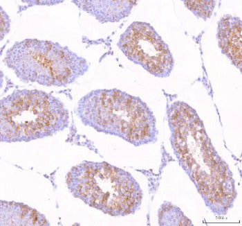 Immunohistochemical staining of STK31 using anti-STK31 antibody. STK31 was detected in a paraffin-embedded section of mouse testis tissue. Heat mediated antigen retrieval was performed in EDTA buffer (pH 8.0, epitope retrieval solution). The tissue section was blocked with 10% goat serum. The tissue section was then incubated with 2 ug/ml rabbit anti-STK31 antibody overnight at 4oC. Peroxidase Conjugated Goat Anti-rabbit IgG was used as secondary antibody and incubated for 30 min at 37oC.