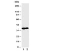 Western blot testing of Kallikrein 9 antibody and Lane 1: MCF-7; 2: A431 cell lysate
