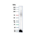 Western blot testing of human pancreas tissue lysate with CLPS antibody (clone CLPS/9021). Predicted molecular weight ~12 kDa.