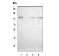 Western blot testing human 1) U-251, 2) SH-SY5Y, 3) U-87 MG and 4) U-2 OS cell lysate. Predicted molecular weight: ~105/125 kDa (unmodified/glycosylated).