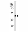 Western blot analysis of lysate from U-251 MG cell line using CXCR7 antibody at 1:1000 for each lane. Predicted molecular weight ~43 kDa.