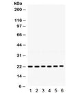 Western blot testing of 1) rat brain, 2) mouse thymus, 3) mouse brain, 4) human HeLa, 5) MCF7 and 6) COLO320 lysate with RAB10 antibody. Expected/observed molecular weight ~22 kDa.