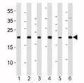Western blot analysis of lysate from 1) HeLa, 2) 293, 3) HT-1080, 4) Raji, 5) SH-SY5Y and 6) THP-1 cell line using BAX antibody at 1:1000.