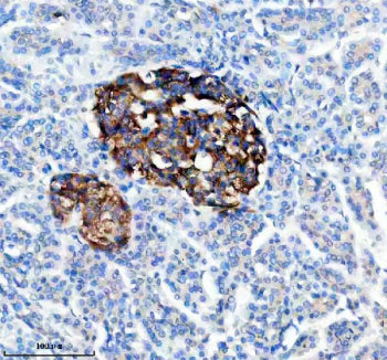IHC analysis of TRIM58 using anti-TRIM58 antibody. TRIM58 was detected in a paraffin-embedded section of human pancreas tissue. Heat mediated antigen retrieval was performed in EDTA buffer (pH 8.0, epitope retrieval solution). The tissue section was blocked with 10% goat serum. The tissue section was then incubated with 2 ug/ml rabbit anti-TRIM58 antibody overnight at 4oC. Peroxidase Conjugated Goat Anti-rabbit IgG was used as secondary antibody and incubated for 30 min at 37oC.