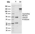 SDS-PAGE analysis of purified, BSA-free CD106 antibody (clone VCAM1/3499) as confirmation of integrity and purity.