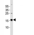 Western blot analysis of lysate from human brain tissue using Map1lc3a antibody diluted at 1:1000.