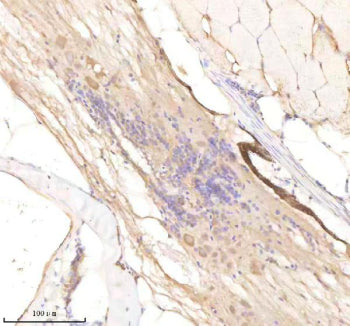 IHC staining of FFPE zebrafish spinal cord tissue with Rcc2 antibody, HRP-labeled secondary and DAB substrate. HIER: boil tissue sections in pH8 EDTA for 20 min and allow to cool before testing.