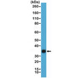 Western blot testing of hCG protein purified from human urine using recombinant HCGb antibody at 1:20,000. Predicted molecular weight ~18 kDa (beta subunit) and ~26 kDa (hCG complex), but can be observed at up to ~40 kDa due to glycosylation.